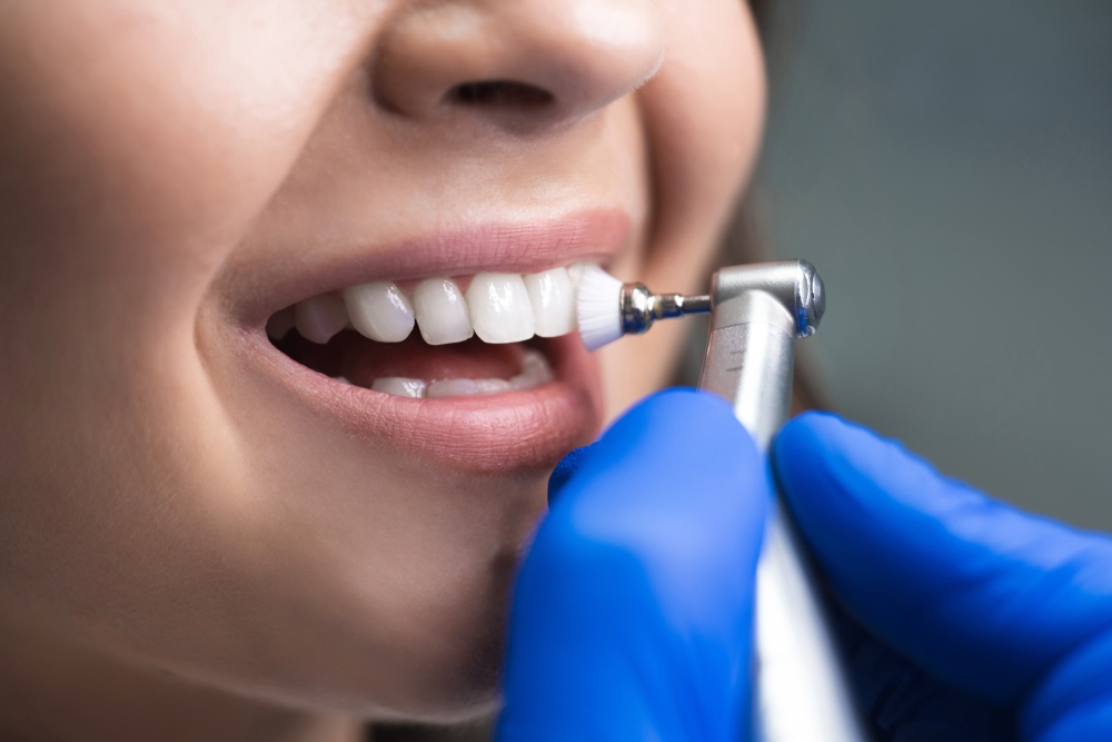 How to remove black spots on teeth causes treatments prevention